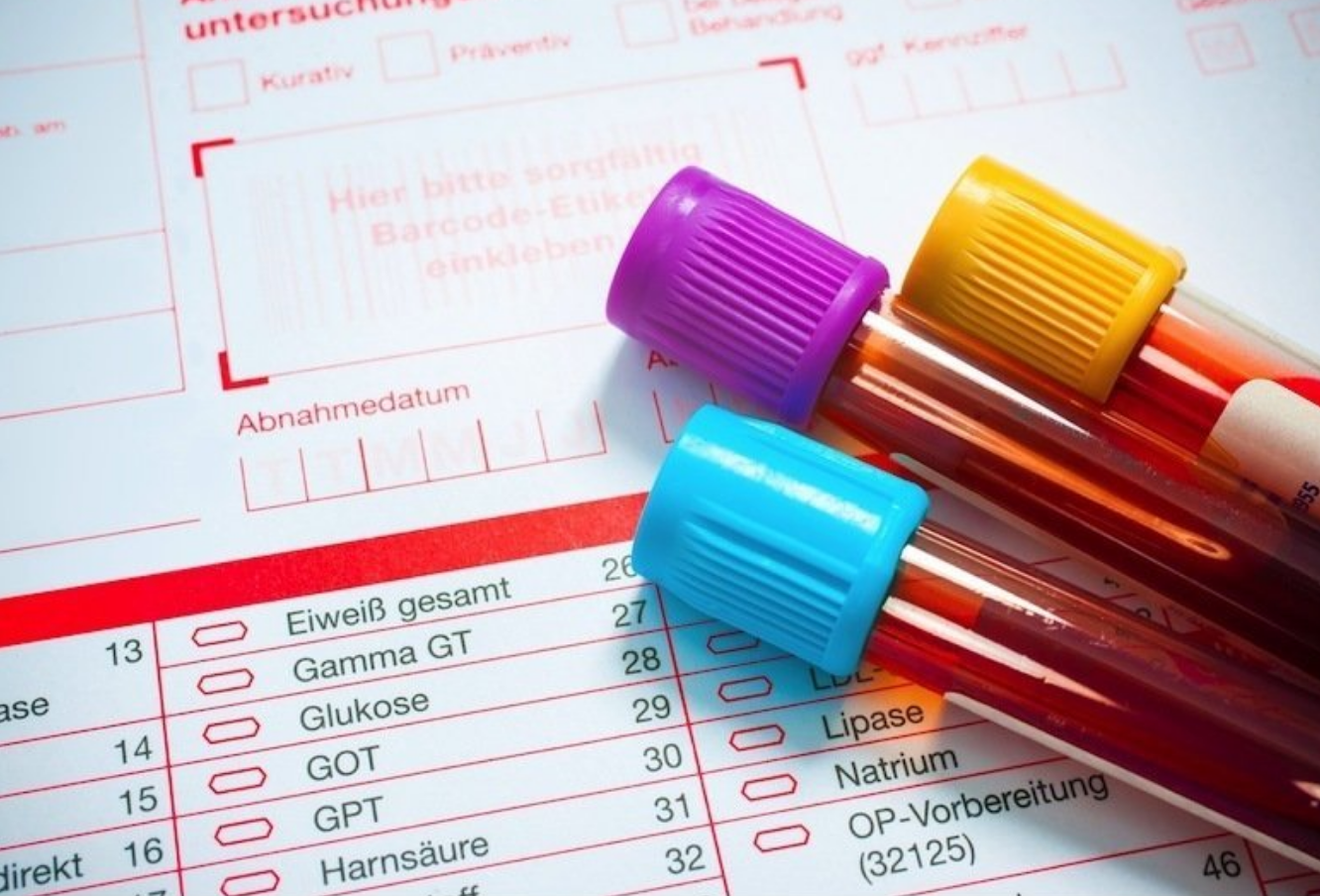 analisi-di-laboratorio